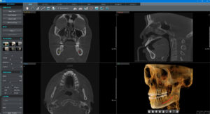 greex ct01