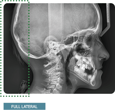 paxi fulllateral